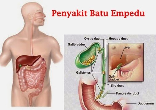 obat herbal